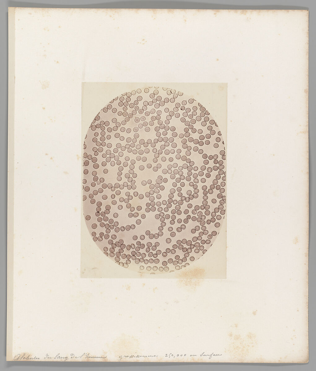 Globules du sang del’homme grossissement 250,000 en Surface [Human Blood Cells], Auguste-Adolphe Bertsch  French, Salted paper print